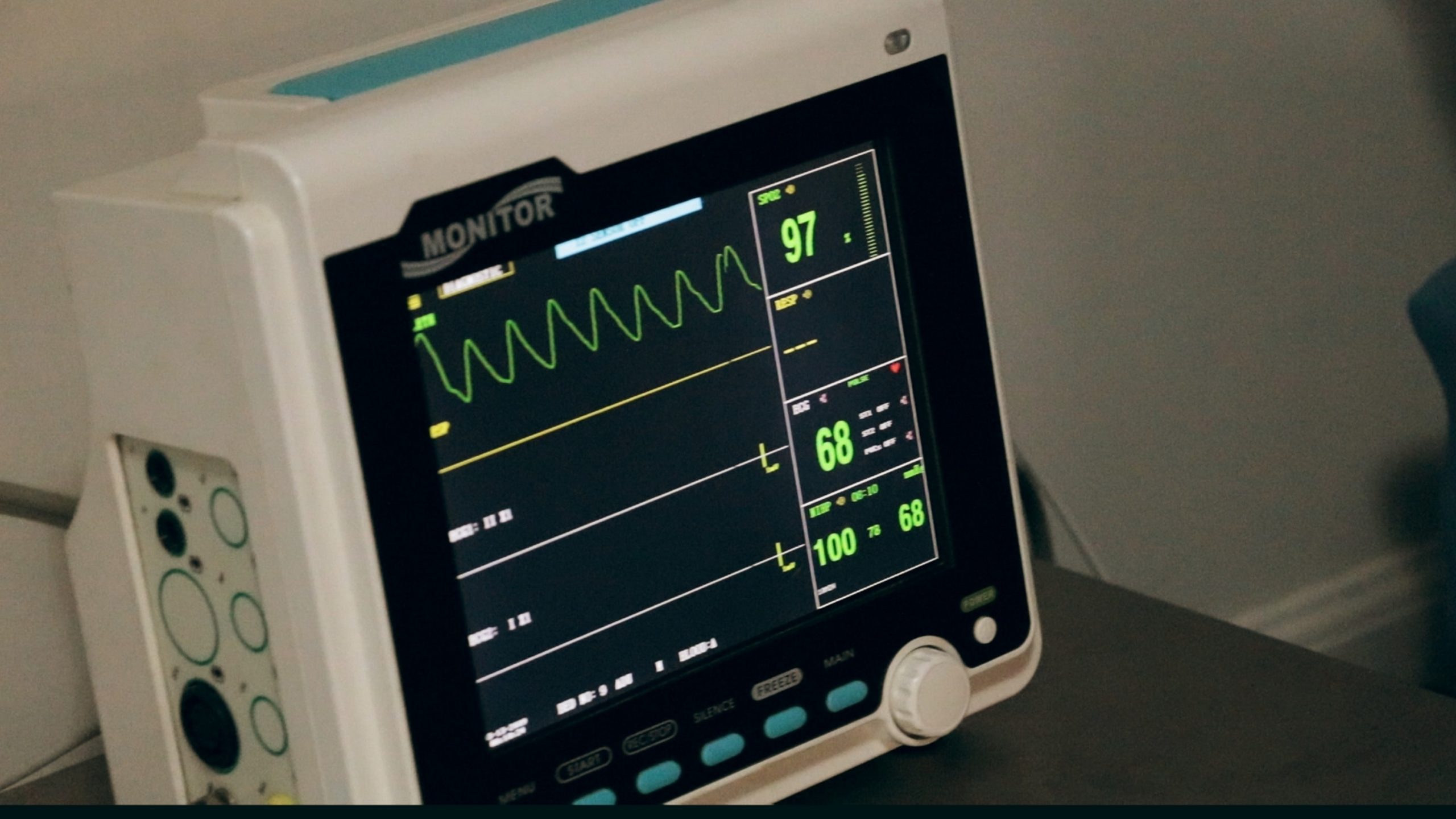 A patient monitor displaying an electrocardiogram